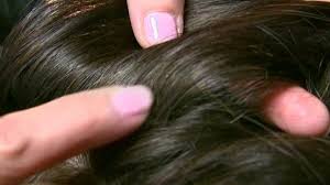 Bambini e i pidocchi (o pediculosi)